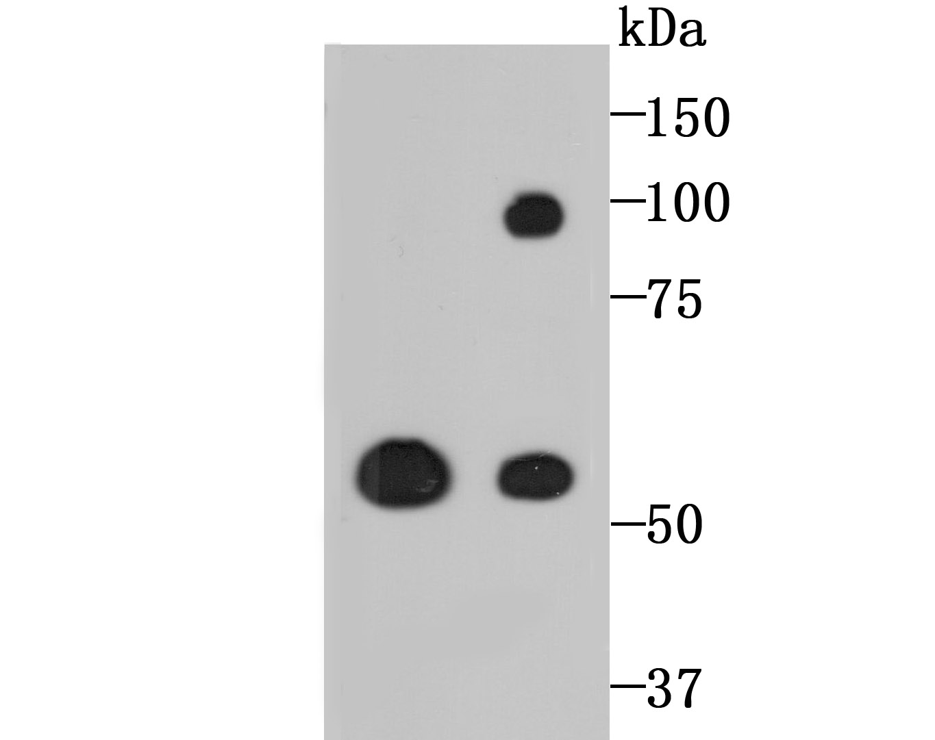 LOXL2 Rabbit mAb