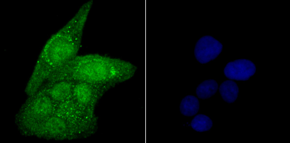 USP22 Rabbit mAb