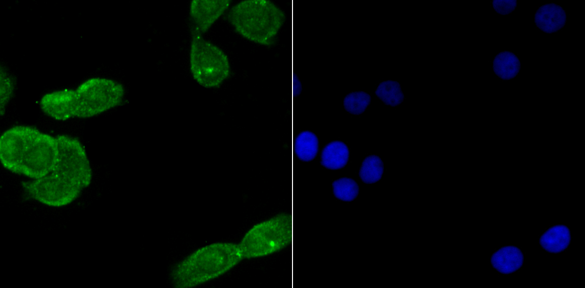 USP22 Rabbit mAb