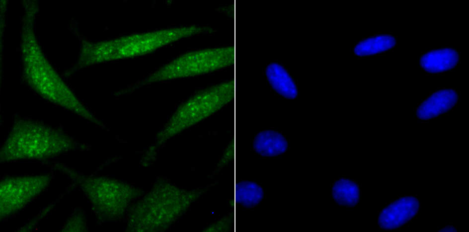 USP22 Rabbit mAb