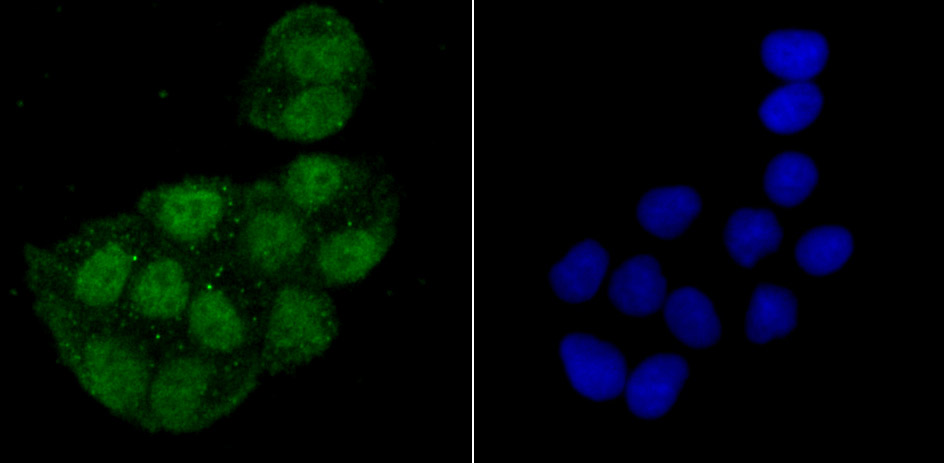 macroH2A.1 Rabbit mAb