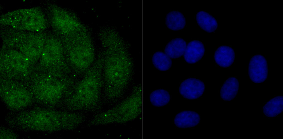 macroH2A.1 Rabbit mAb