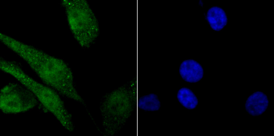 macroH2A.1 Rabbit mAb