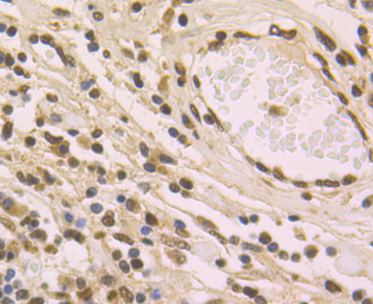 macroH2A.1 Rabbit mAb