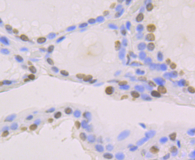 macroH2A.1 Rabbit mAb