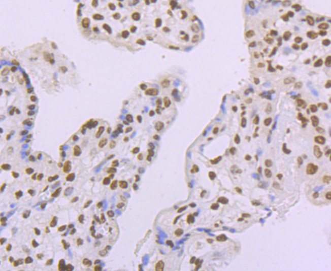 macroH2A.1 Rabbit mAb