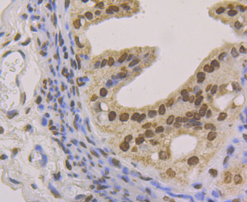 macroH2A.1 Rabbit mAb