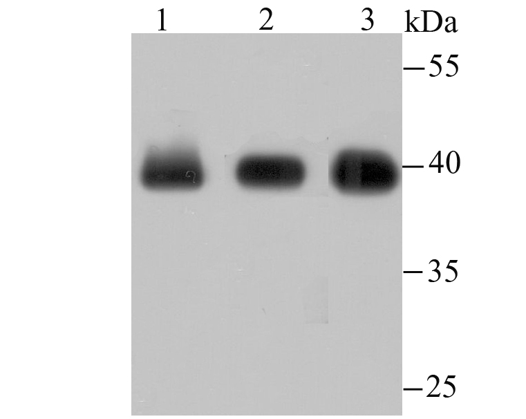 macroH2A.1 Rabbit mAb