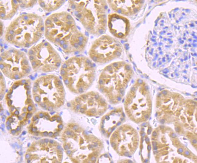 Zyxin Rabbit mAb