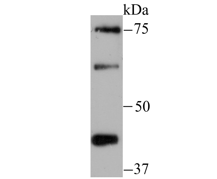 Zyxin Rabbit mAb