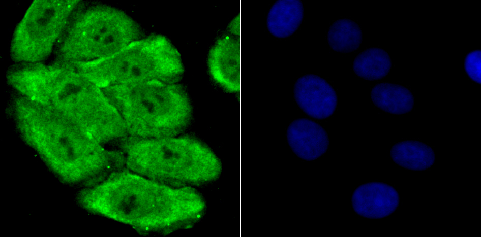 PSMA1 Rabbit mAb