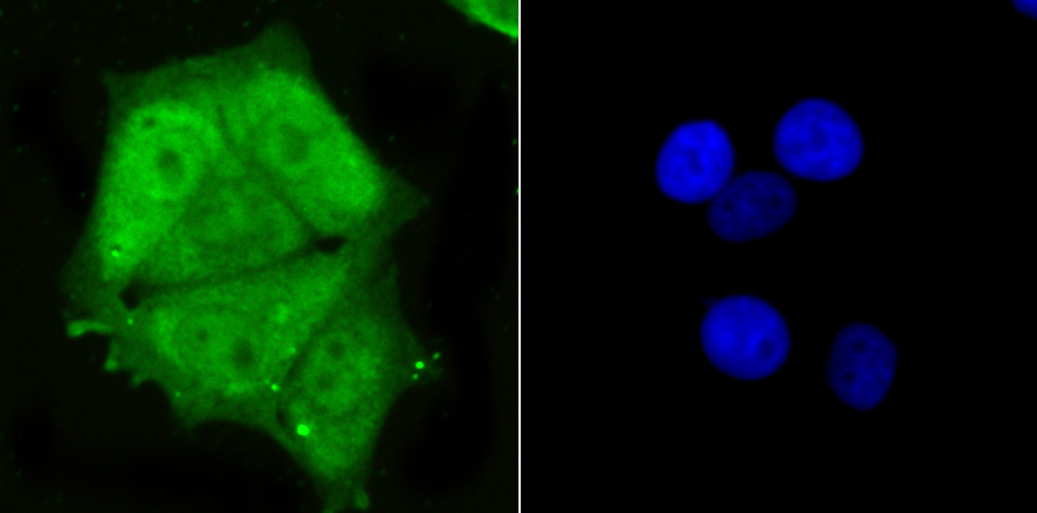 PSMA1 Rabbit mAb