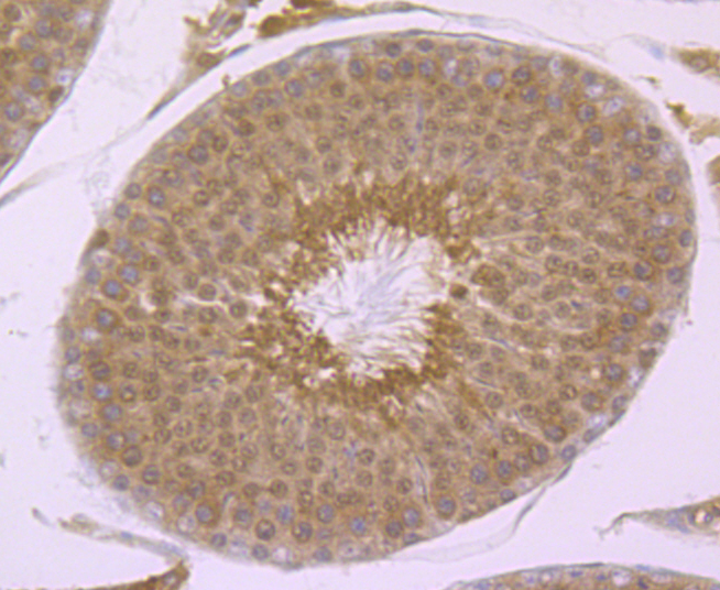 PSMA1 Rabbit mAb