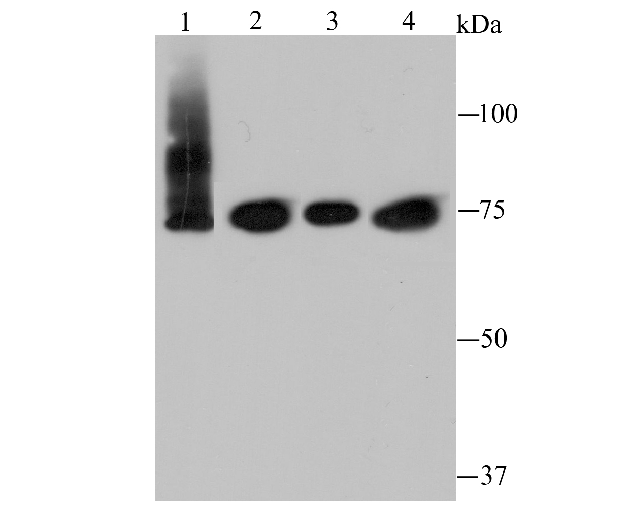 IKBKE Rabbit mAb