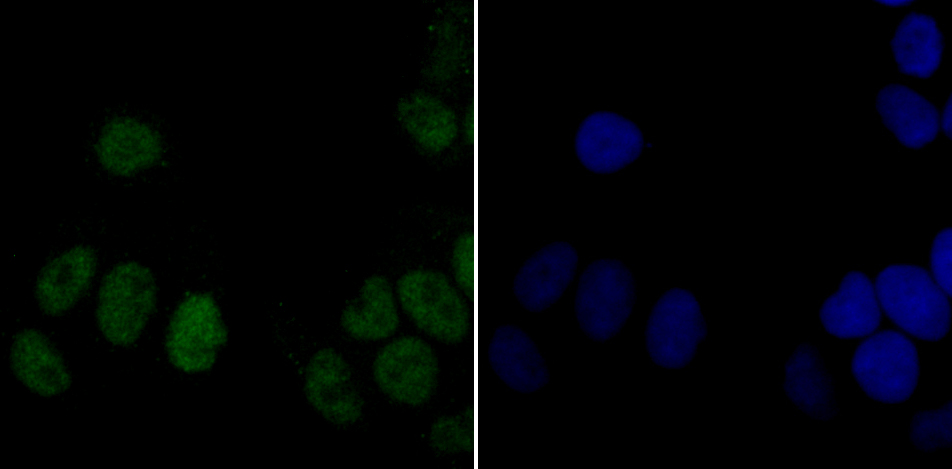 DDB1 Rabbit mAb