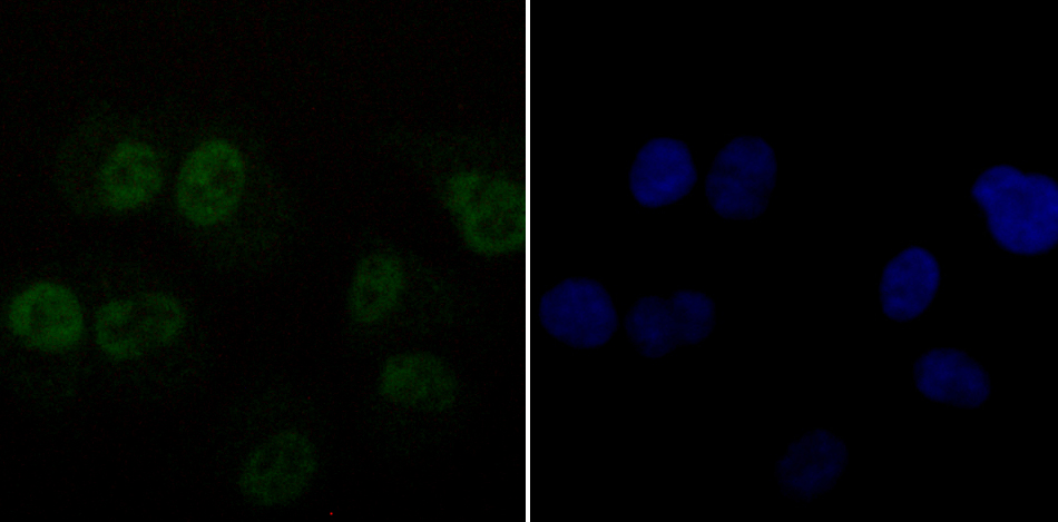 DDB1 Rabbit mAb