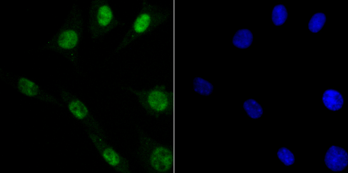 DDB1 Rabbit mAb