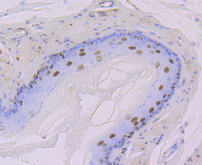 DDB1 Rabbit mAb