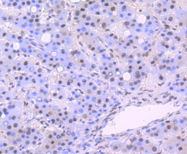 DDB1 Rabbit mAb