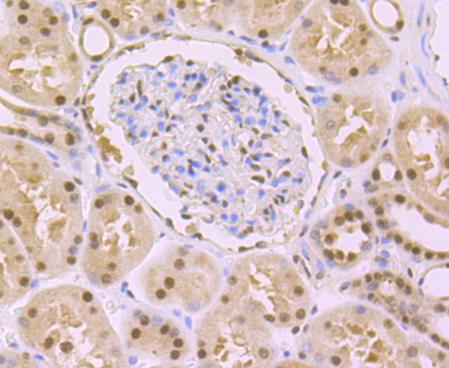 DDB1 Rabbit mAb