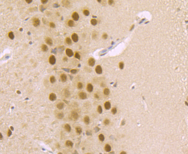 DDB1 Rabbit mAb