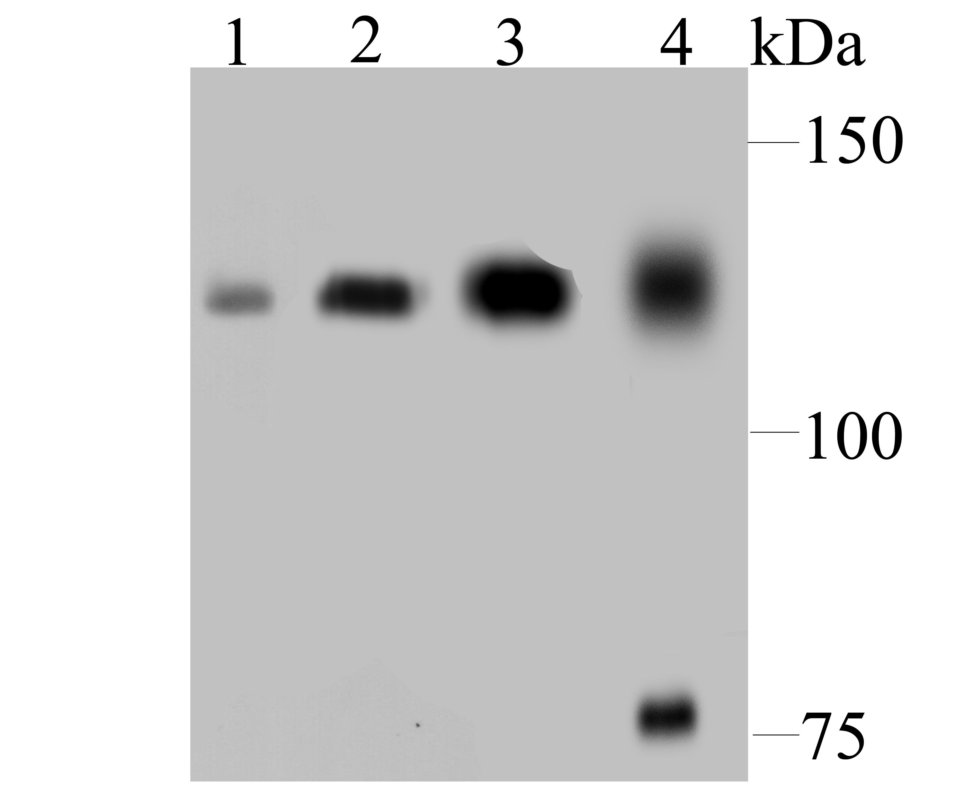 DDB1 Rabbit mAb