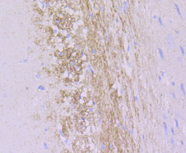 alpha Internexin Rabbit mAb