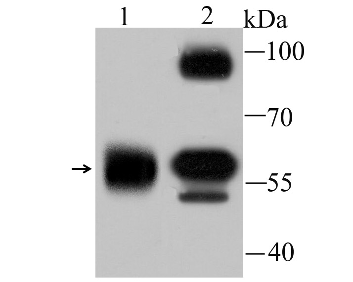 alpha Internexin Rabbit mAb