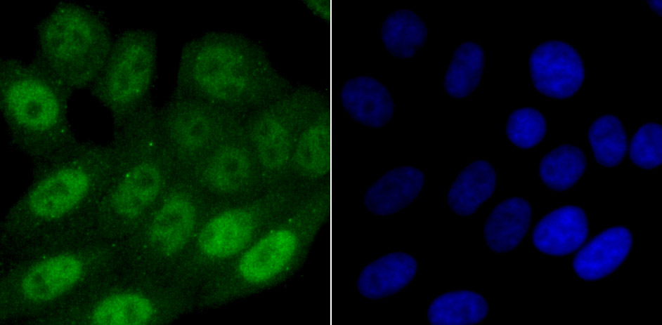 SAMHD1 Rabbit mAb