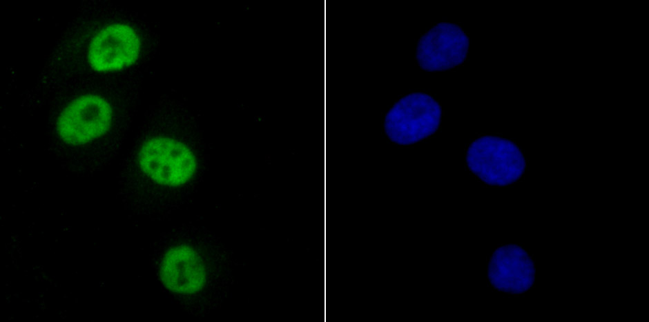 SAMHD1 Rabbit mAb