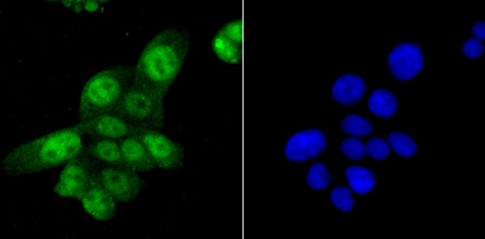 SAMHD1 Rabbit mAb