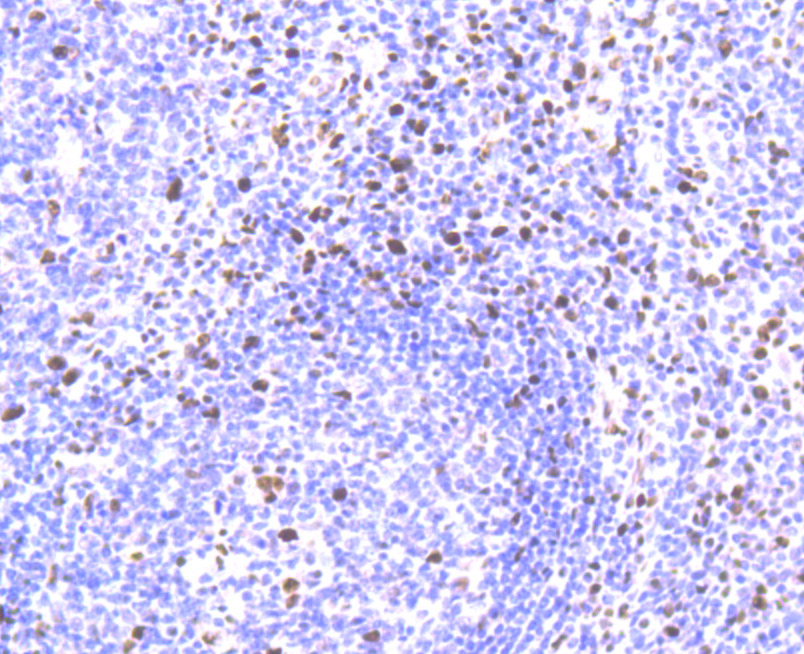 SAMHD1 Rabbit mAb