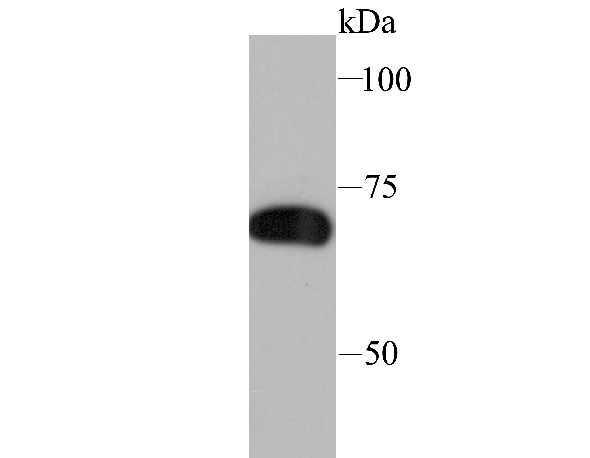 SAMHD1 Rabbit mAb