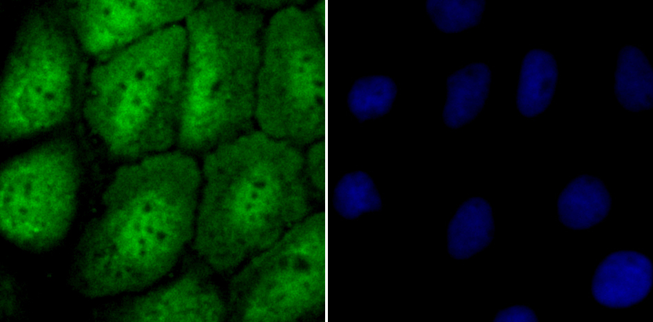 NUP153 Rabbit mAb