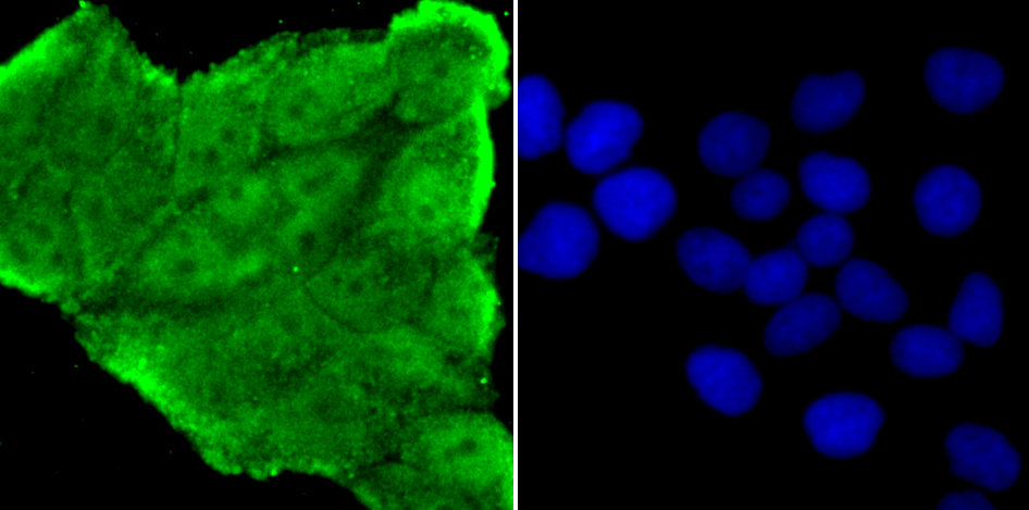 NUP153 Rabbit mAb