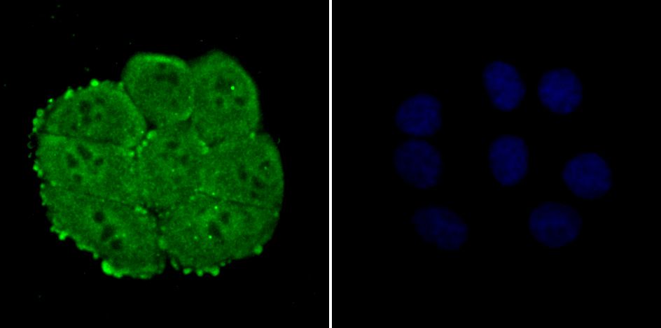 NUP153 Rabbit mAb