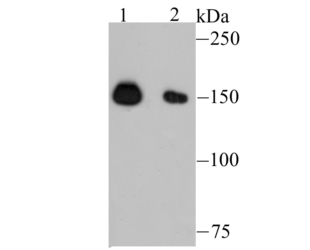 NUP153 Rabbit mAb