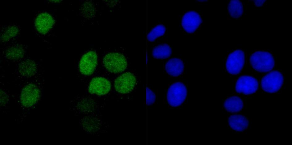 Histone H1.2 Rabbit mAb