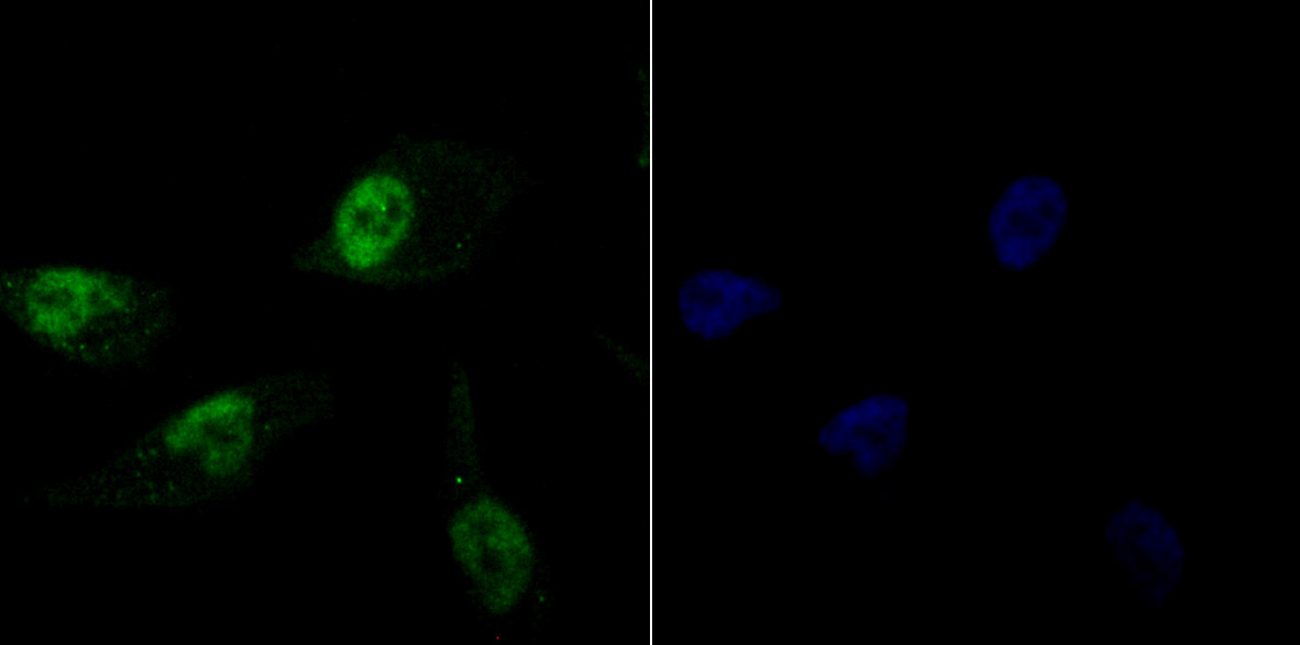 Histone H1.2 Rabbit mAb