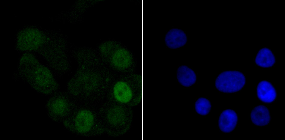 Histone H1.2 Rabbit mAb