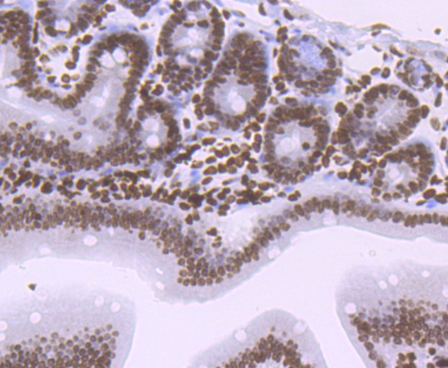 Histone H1.2 Rabbit mAb