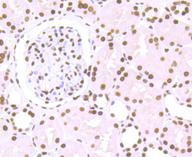 Histone H1.2 Rabbit mAb