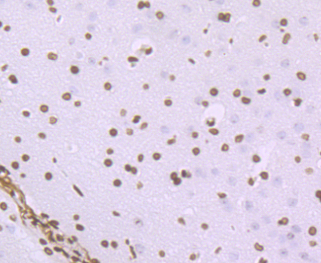 Histone H1.2 Rabbit mAb