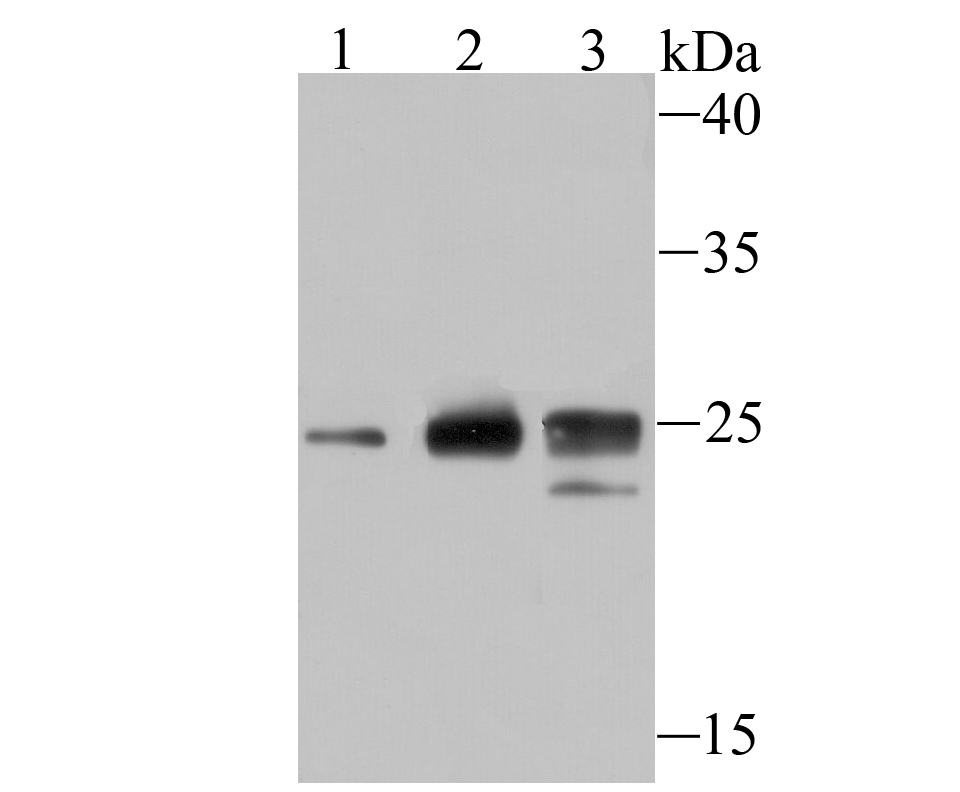 Histone H1.2 Rabbit mAb