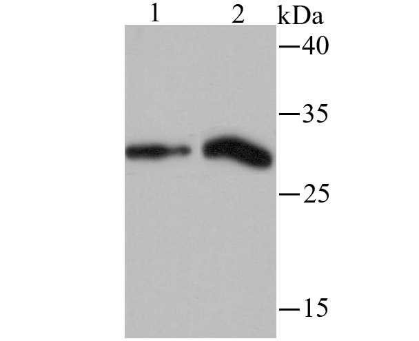 Histone H1.2 Rabbit mAb