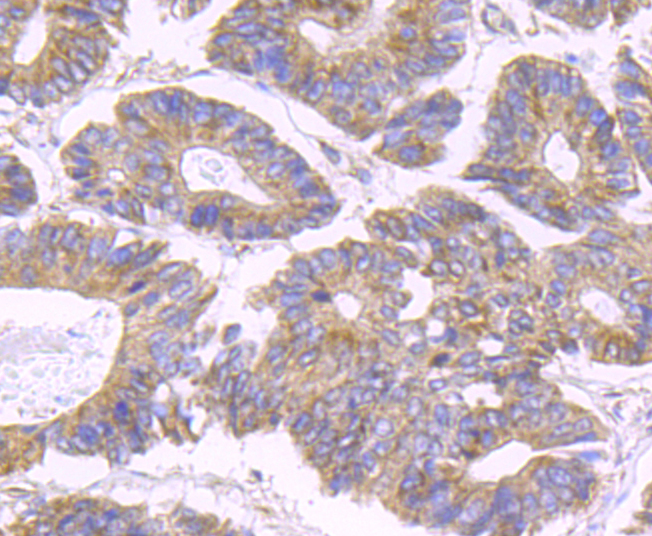 SDHB Rabbit mAb