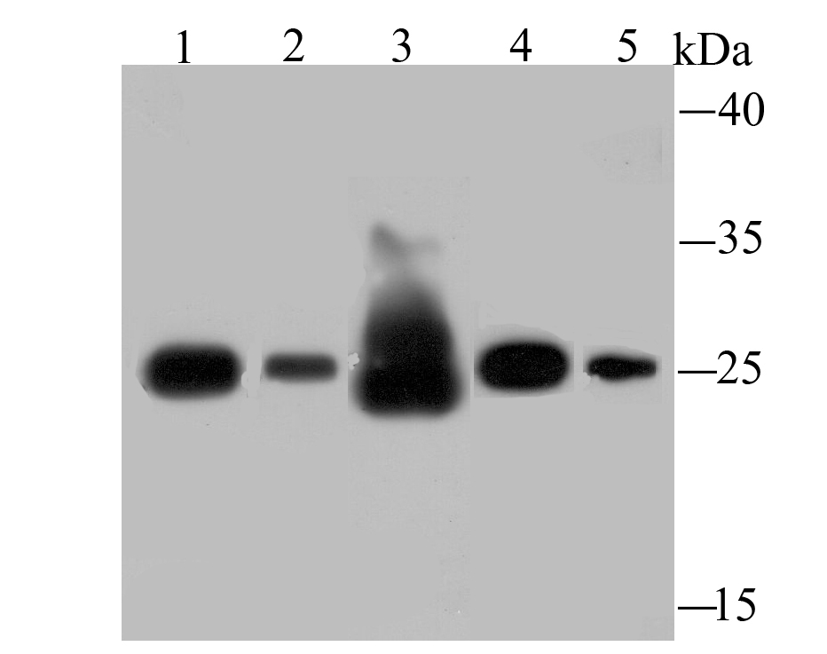 SDHB Rabbit mAb