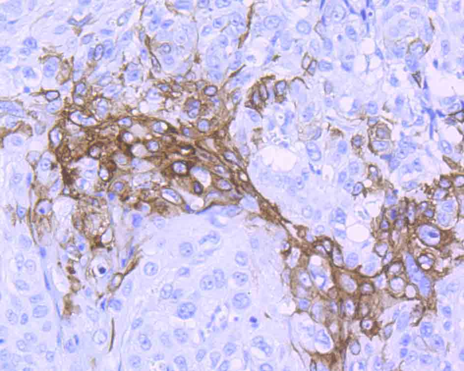 Wnt5a Rabbit mAb