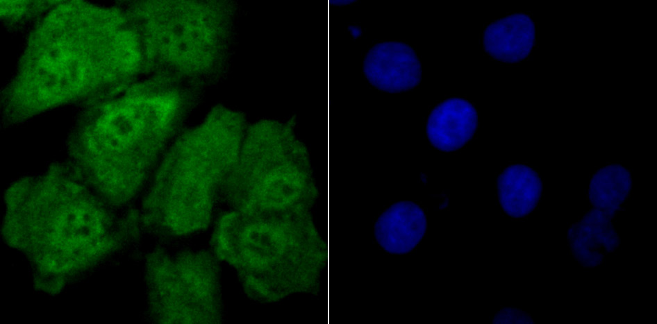 Drosha Rabbit mAb