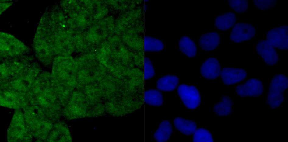 Drosha Rabbit mAb